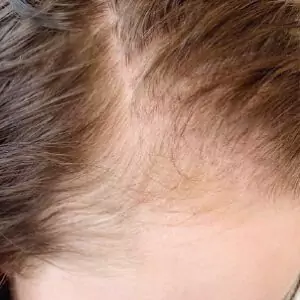 Before Image
